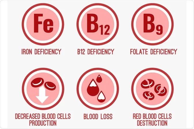 Causes of Anemia Illustration